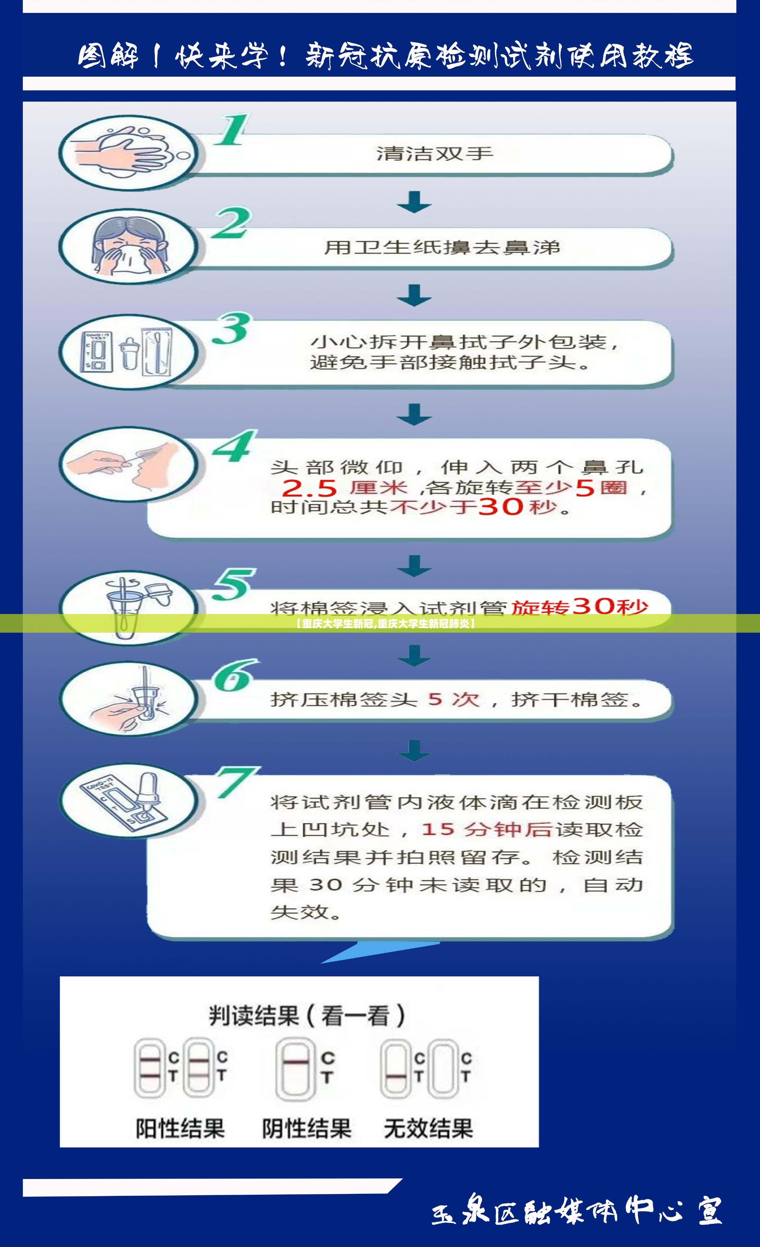 【重庆大学生新冠,重庆大学生新冠肺炎】